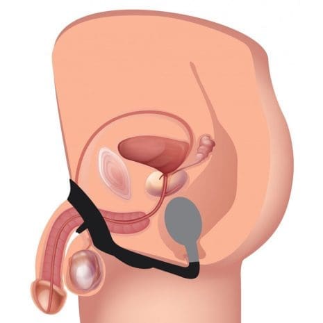 AG561x3.jpg AG561x3.jpg